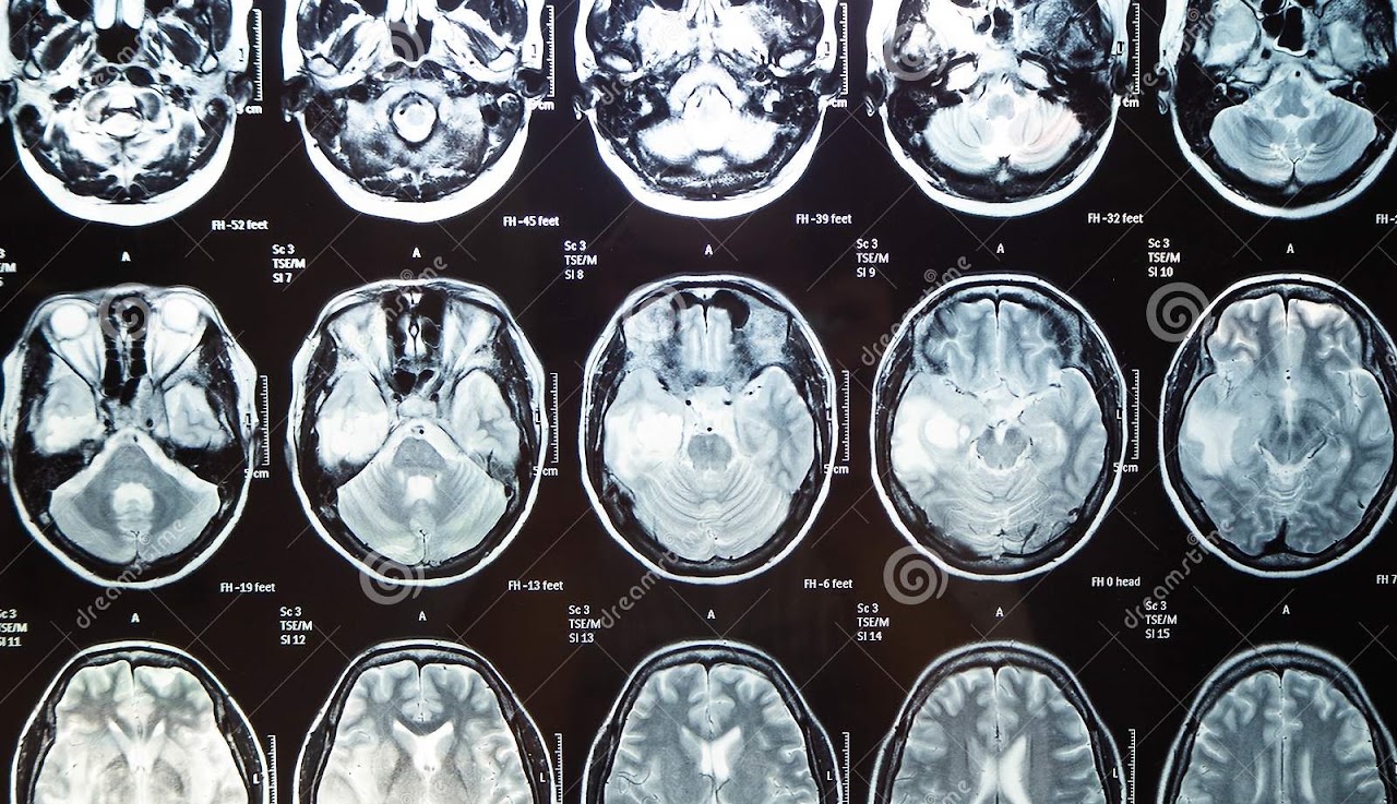 Medical imaging slices for medtech AI workflows